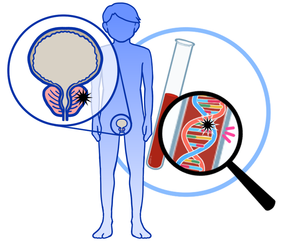 前立腺がん解析イメージイラスト